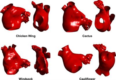 Computational Fluid Dynamic Analysis of the Left Atrial Appendage to Predict Thrombosis Risk